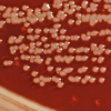Figure 1. Yersinia enterocolitica bacteria growing on a Xylose Lysine Sodium Deoxycholate (XLD) agar plate.