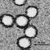 Electron microscopy of West Nile virus, taken from lab.