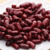 Figure 1. Kidney beans are one of many legumes, all of which contain folate. Some other legumes include white kidney beans (cannellini beans), black beans, pinto beans, chickpeas, lima beans, and lentils.