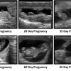 examples of ultrasound images