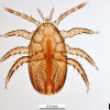 Figure 1. Adult female Tropilaelaps.
