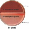 Figure 1. Bi-plate of Minnesota Easy Culture System II. (Top: Factor agar. Bottom: MacConkey agar.)