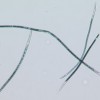 Figure 1. Sting nematode Belonolaimus longicaudatus. Credit: W. T. Crow, University of Florida