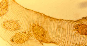 Figure 10. Five tracheal mites visible in a dissected honey bee trachea