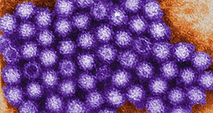 Transmission electron micrograph of norovirus particles