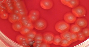A colony of Bacillus cereus