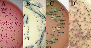 Figure 1. STEC isolation from various selective media. (A) Cells from enrichment broth are plated on CT-SMAC. (B) Suspect colonies appear as pale on CT-SMAC and steel blue on NT-Rainbow Media, and non-O157 STECs appear as pink colonies on NT-Rainbow (C) Suspect STECS expressing b-galactosidase and hemolysin are indicated by blue colonies with a zone of clearing on Sheeps blood agar (D) Typical non-O157 STECs are shown growing on CHROMagar and appear as blue colonies. Credits: Mike Cooley